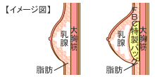 乳腺下法 イメージ
